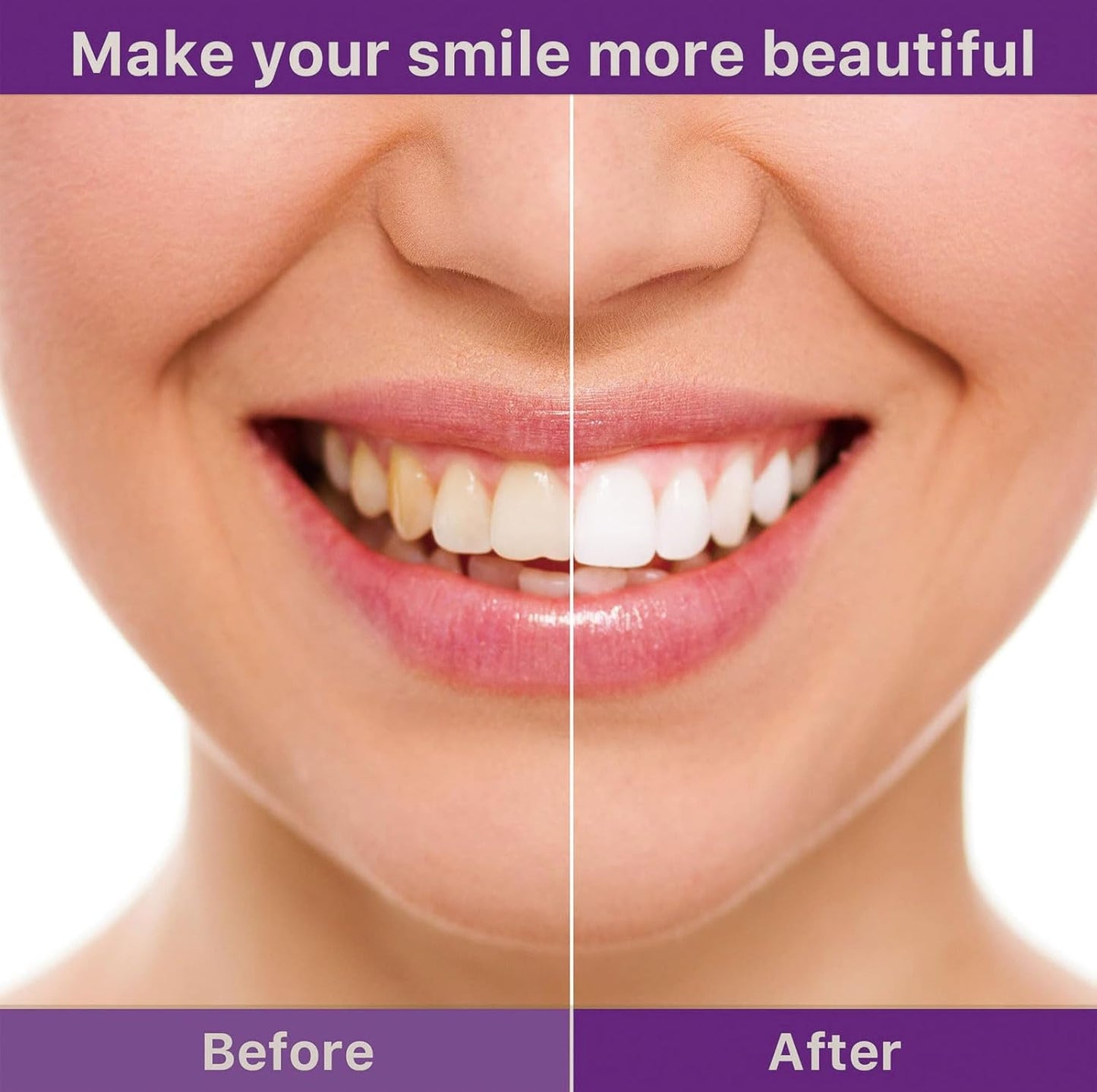 ✨Clinclii™ V36 Whitening Strips – Professional Teeth Whitening at Home(UPGRADED VERSION)